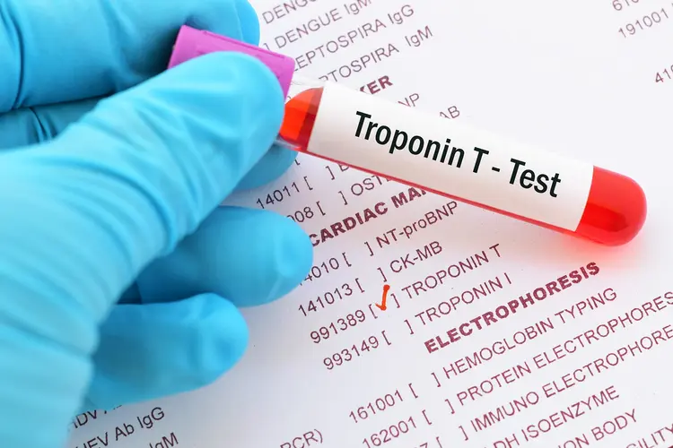 Cardiovascular Risk Assessment
